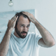 Imagen para el artículo titulado Cómo verificar si tu pérdida de cabello está dentro de los límites normales